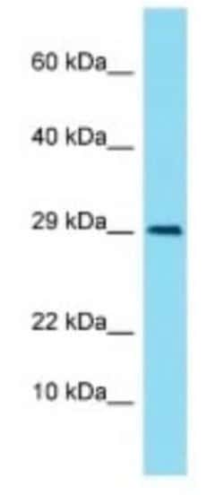 LIMS3 Rabbit anti-Human, Polyclonal, Novus Biologicals:Antibodies:Primary
